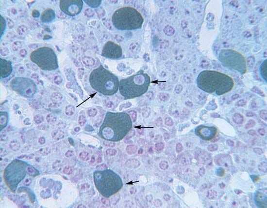Gonadotroph cell