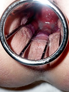 Gay Anal Gape Pics