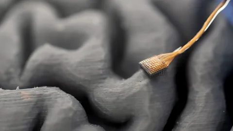 A woman wearing a face mask and gloves connects a wire to the microelectrode impant on a patient's head (Credit: University of California, Davis)