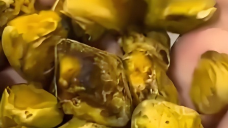 意大利小偷把肾结石当成黄金偷走